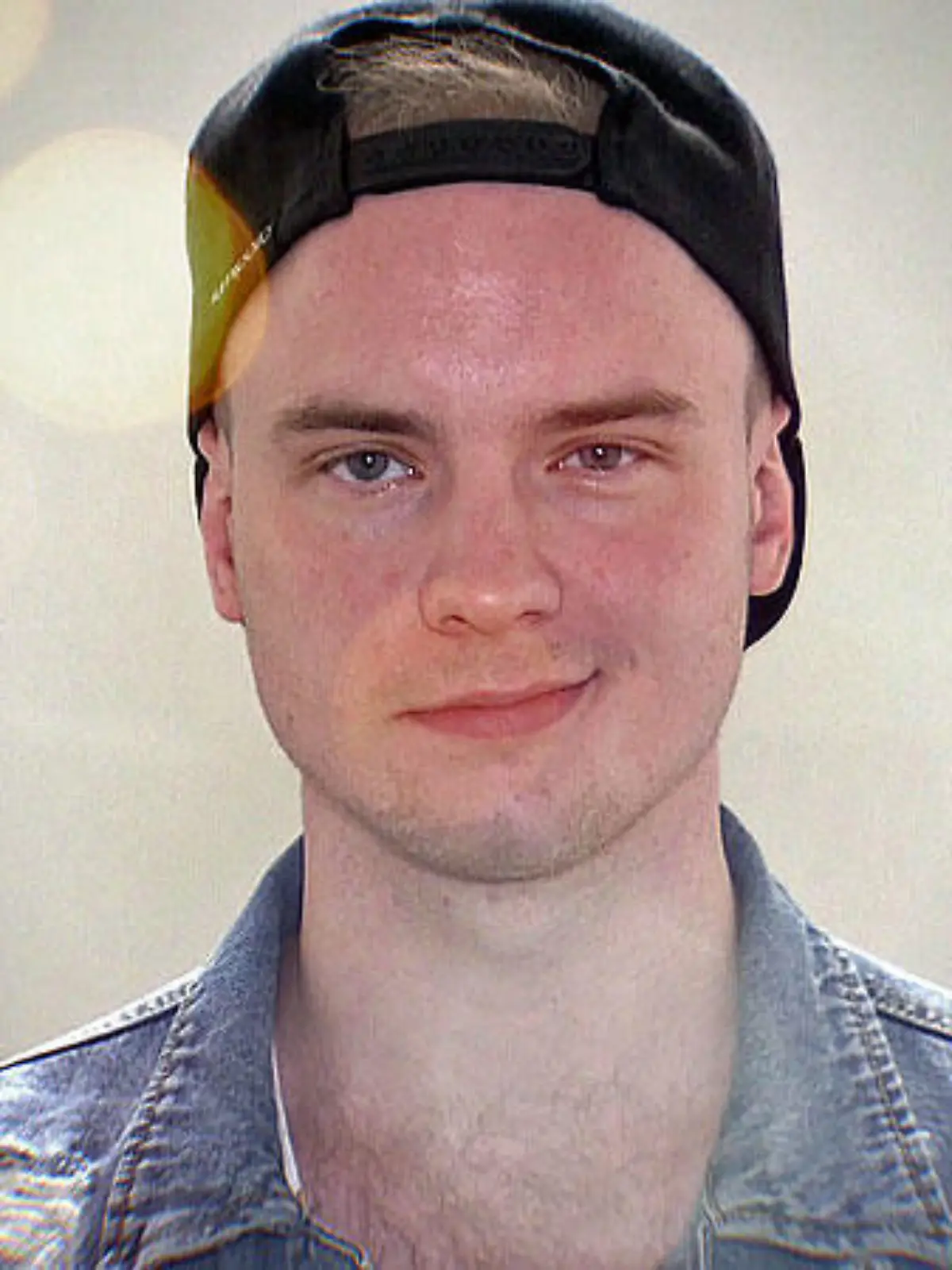 Toni Kraus leidet unter einer Gesichtslähmung