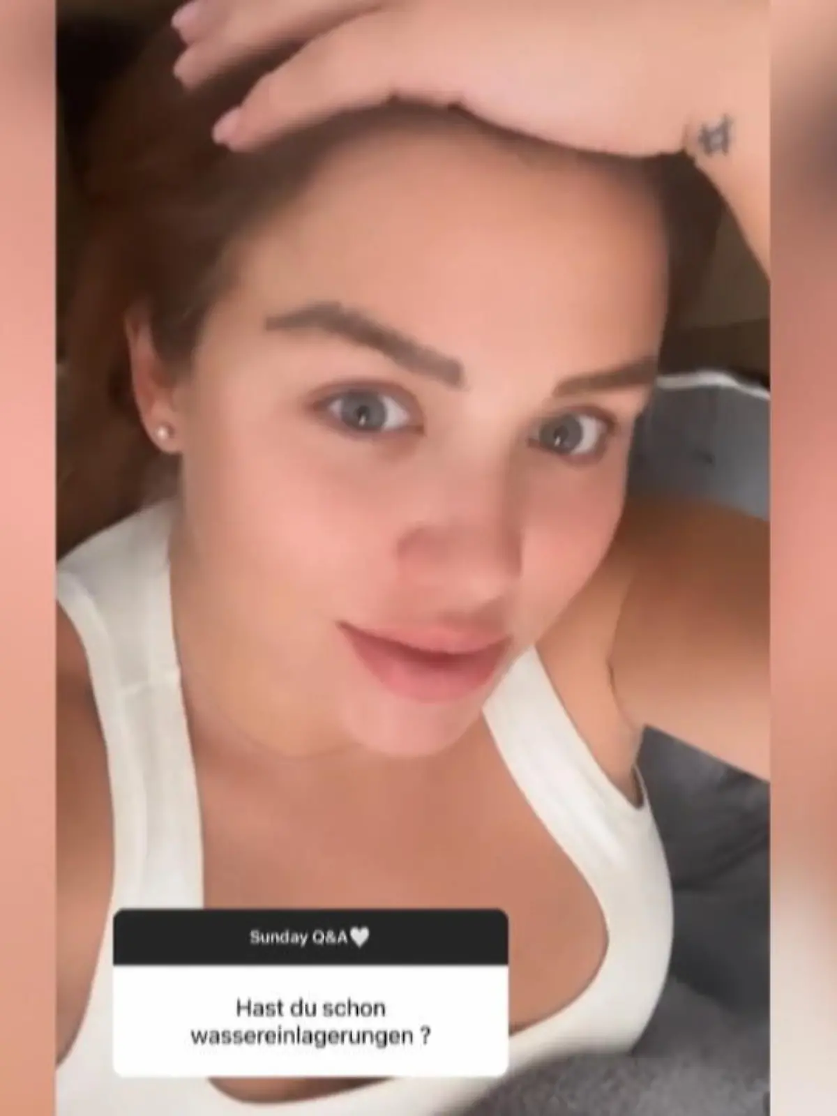 Bild zu: "Kim Gloss hat extreme Wassereinlagerungen"
