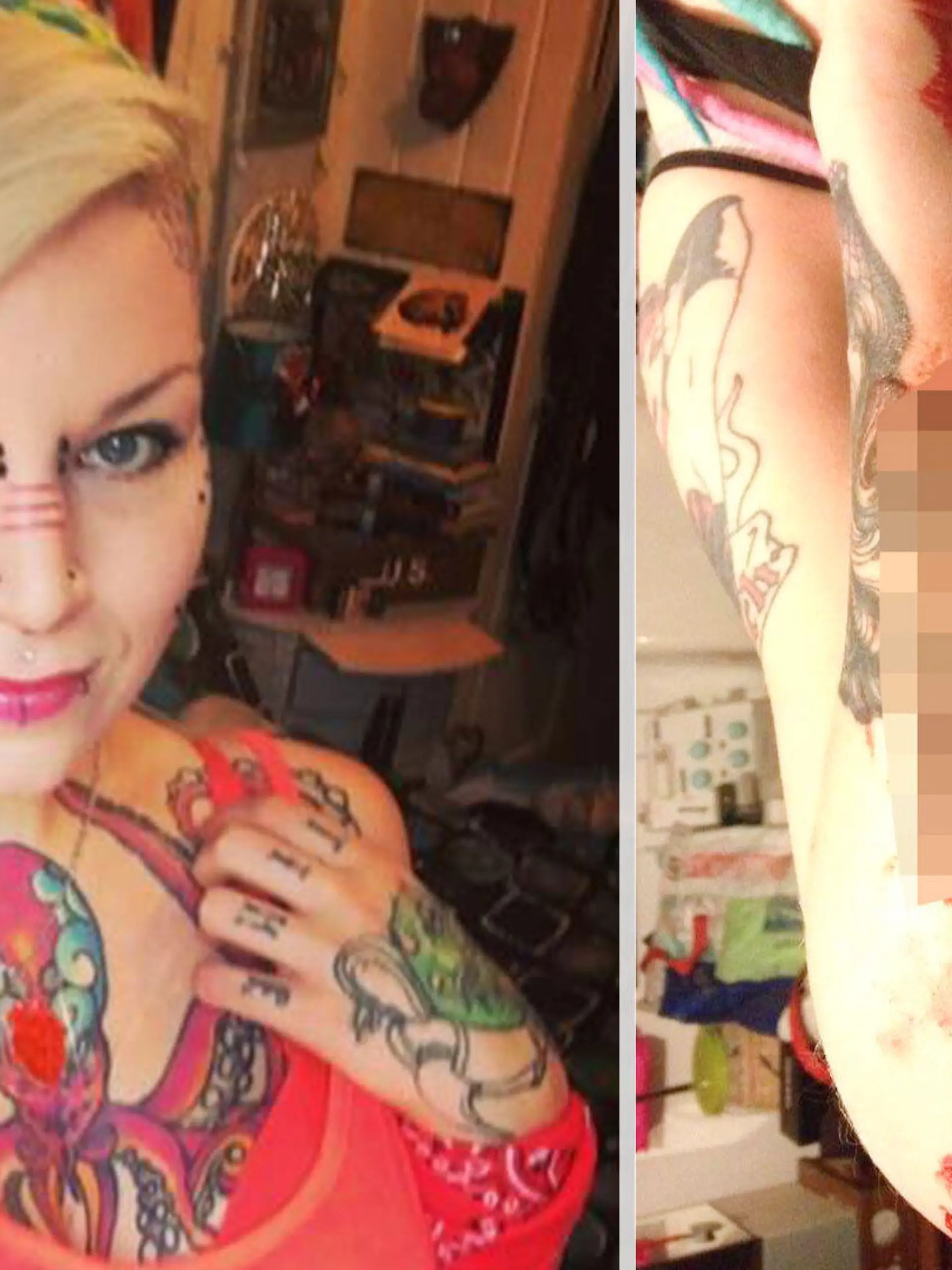 Torz Reynolds mit blutigem Arm, aus dem ihr Liebestattoo geschnitten wurde