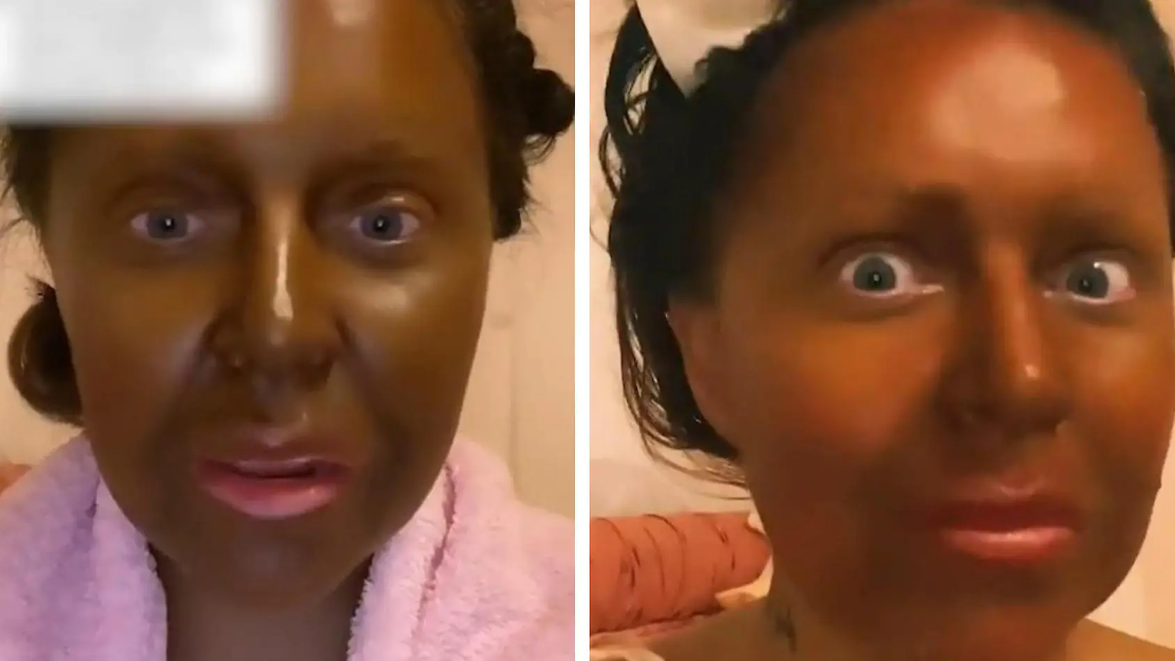 Selbstbräuner endet in Katastrophe