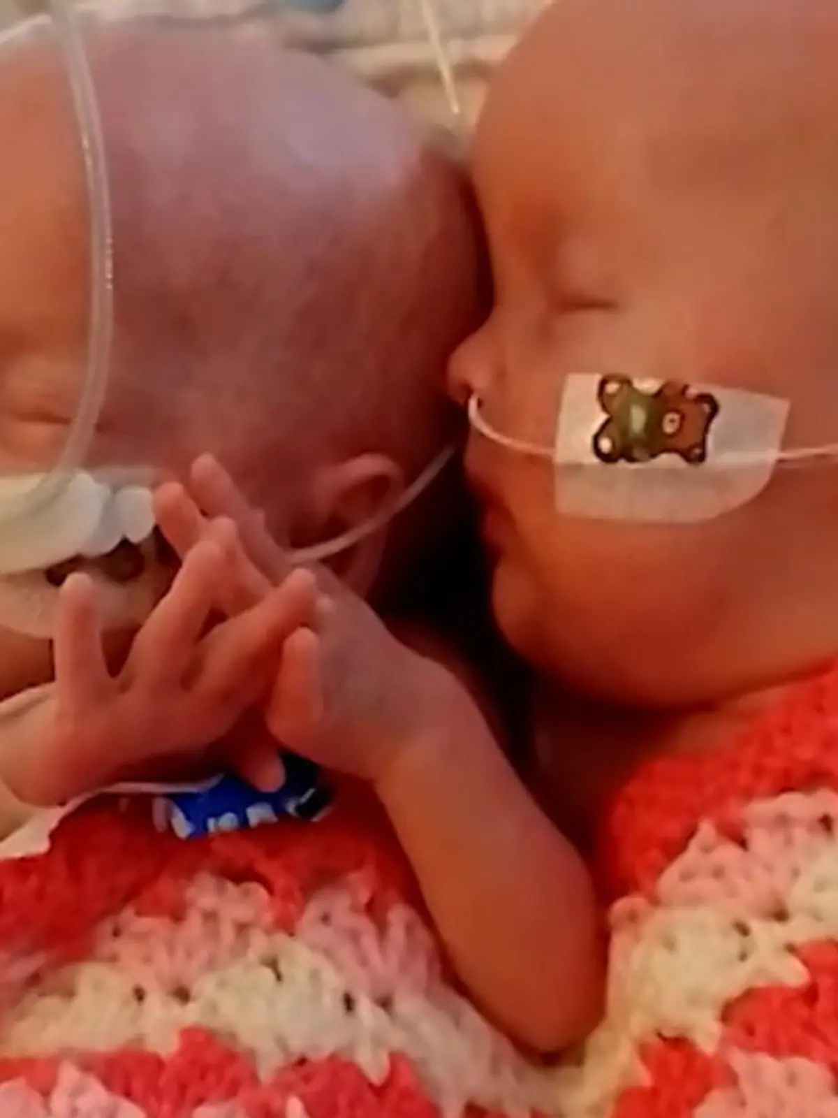 Dass Meabh und Clodagh heute BEIDE gesund und munter sind, grenzt an ein medizinisches Wunder. Im Mutterbauch litten sie am Zwillings-Transfusions-Syndrom und schwebten in Lebensgefahr. Wie sie es doch geschafft haben, zeigen wir im Video.