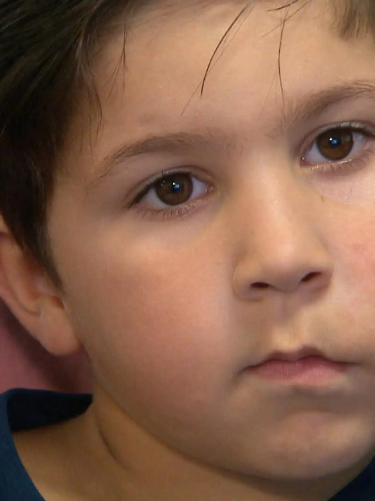 Seit er 2 Jahre alt ist, wird die linke Wange des 6-jährigen Can immer dicker und dicker. Seine Mutter Aylin hat bereits einen jahrelangen Ärzte-Marathon hinter sich. Aber eine genaue Diagnose bekommt sie nie. Nur durch einen wirklich unglaublichen Zufall erfahren seine Eltern, was wirklich der Grund für Cans geschwollene Wange ist. Denn Cans Stiefvater Eddie sieht plötzlich einen alten RTL-TV-Beitrag aus 2020, der Licht ins Dunkel bringen könnte. Und tatsächlich: Wie sich herausstellt, hat Can tatsächlich den im Beitrag geschilderten, seltenen Gen-Defekt "Facial infiltrating lipomatosis" - kurz "FIL". Wie es Can und seinen Eltern mit der Diagnose geht, zeigt Ihnen Marcus Seesing im Video!