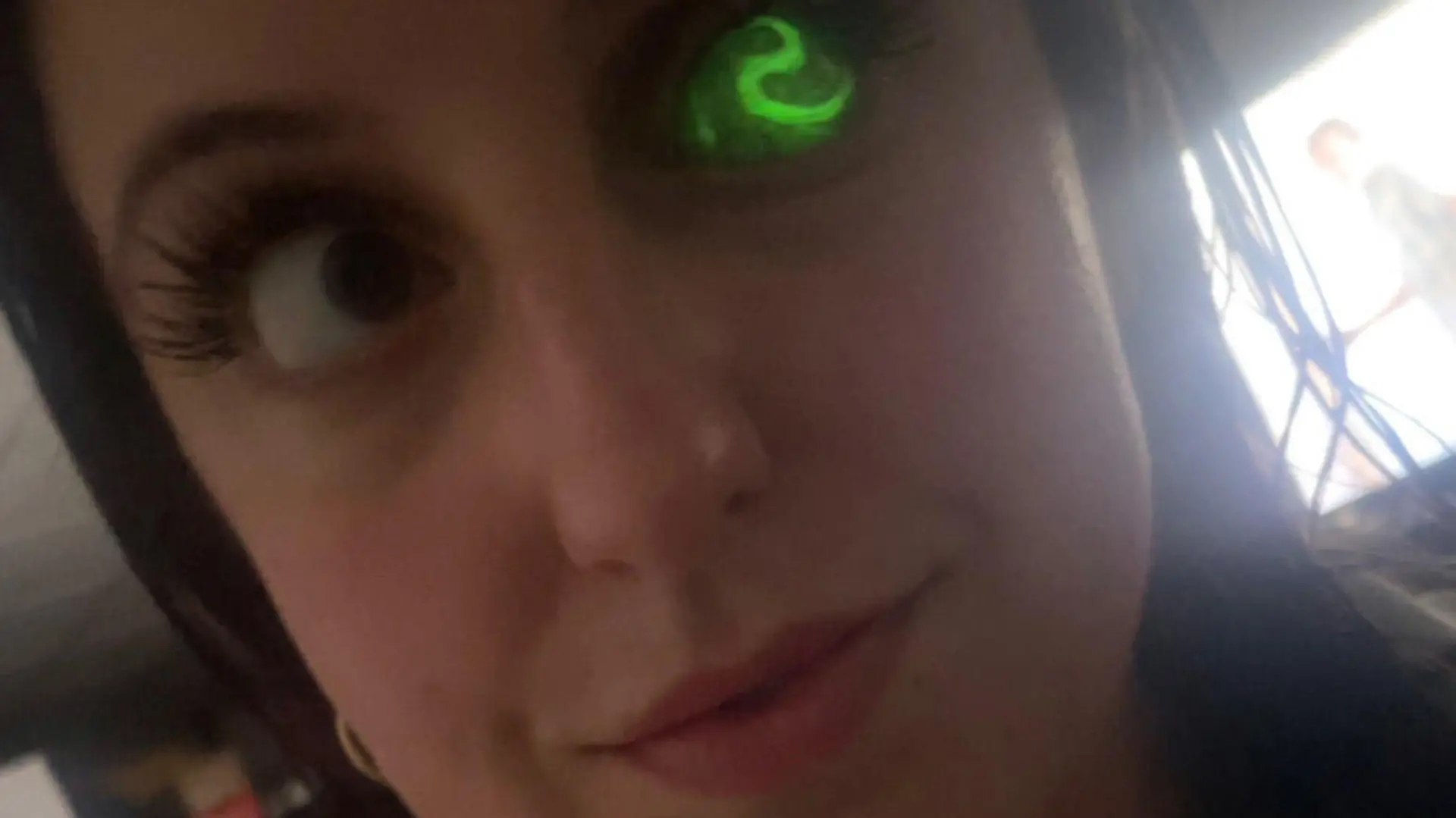 Story from Jam Press (Prosthetic Eye)

Pictured: Rachel Mayta.

'I lost my EYE to cancer after doctors spotted a white GLOW in pictures,' says woman, 32, issuing warning to parents

A woman has revealed she lost her eye to cancer – after doctors spotted a strange white glow in pictures of it.

Rachel Mayta, 32, from Portland, Oregon, US, seemed perfectly healthy until she was 18 months old and a doctor spotted something strange in her eye.

He asked for pictures of her and saw a sure sign that something was amiss – her right eye appeared to be emitting a glow in the image.

The white glow in flash photography can indicate eye disease – or worse, cancer.

Rachel was diagnosed with retinoblastoma, an eye cancer that begins in the retina and most commonly affects young children, in October 1991.

Doctors explained there was no chance of saving the eye and it had to be removed urgently to prevent the cancer spreading, so just four days later the eyeball was removed.

Luckily, she doesn’t remember much of her cancer journey until she was fitted with her first prosthetic when she was 20 months old.

She also recalls not being massively affected by having just one eye and always wore a prosthetic – though children nicknamed her “Cyclopes” as a result.

It wasn’t until her mid-20s that she suffered any self-confidence issues, after having a surgery designed to replace the implant holding her prosthetic in place.

“After surgery and the healing process, my eye lost most of its ability to blink,” Rachel, who works as a hairstylist, told NeedToKnow.

“A surgery where I had expected the outcome to result in more mobility of the eye and a more realistic looking prosthetic became the exact opposite.

“Prior to this surgery most people wouldn’t have even noticed my eye, but afterwards it was very apparent.

“I was very aware of the people looking at me, I had people say mean things and talk to me differently.

“I was seeing this guy and after a couple