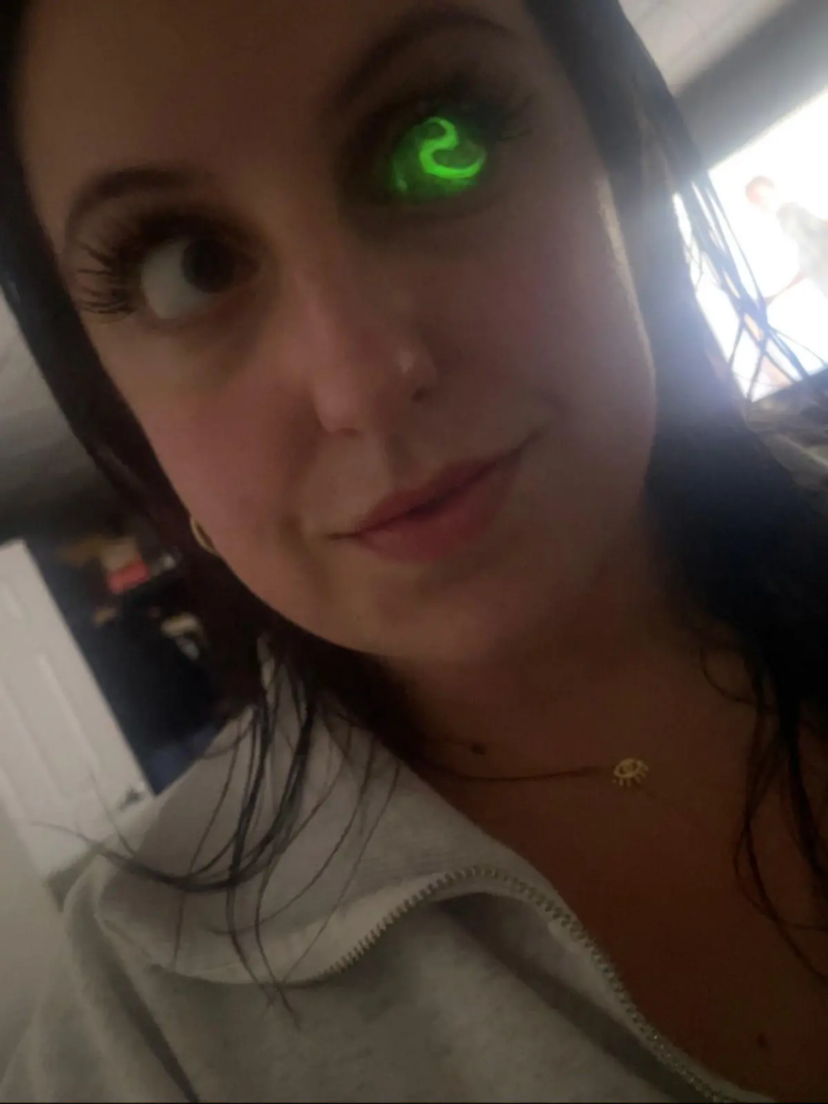 Story from Jam Press (Prosthetic Eye)

Pictured: Rachel Mayta.

'I lost my EYE to cancer after doctors spotted a white GLOW in pictures,' says woman, 32, issuing warning to parents

A woman has revealed she lost her eye to cancer – after doctors spotted a strange white glow in pictures of it.

Rachel Mayta, 32, from Portland, Oregon, US, seemed perfectly healthy until she was 18 months old and a doctor spotted something strange in her eye.

He asked for pictures of her and saw a sure sign that something was amiss – her right eye appeared to be emitting a glow in the image.

The white glow in flash photography can indicate eye disease – or worse, cancer.

Rachel was diagnosed with retinoblastoma, an eye cancer that begins in the retina and most commonly affects young children, in October 1991.

Doctors explained there was no chance of saving the eye and it had to be removed urgently to prevent the cancer spreading, so just four days later the eyeball was removed.

Luckily, she doesn’t remember much of her cancer journey until she was fitted with her first prosthetic when she was 20 months old.

She also recalls not being massively affected by having just one eye and always wore a prosthetic – though children nicknamed her “Cyclopes” as a result.

It wasn’t until her mid-20s that she suffered any self-confidence issues, after having a surgery designed to replace the implant holding her prosthetic in place.

“After surgery and the healing process, my eye lost most of its ability to blink,” Rachel, who works as a hairstylist, told NeedToKnow.

“A surgery where I had expected the outcome to result in more mobility of the eye and a more realistic looking prosthetic became the exact opposite.

“Prior to this surgery most people wouldn’t have even noticed my eye, but afterwards it was very apparent.

“I was very aware of the people looking at me, I had people say mean things and talk to me differently.

“I was seeing this guy and after a couple