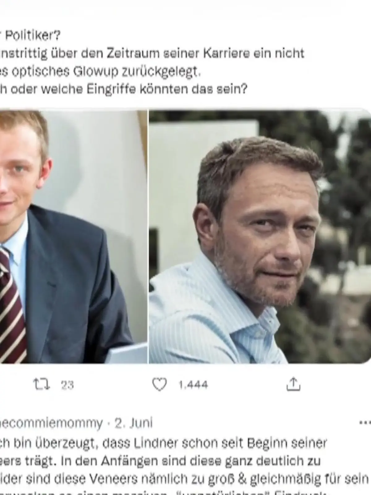 Hat Christian Lindner sich etwa mehreren Beauty-OPs unterzogen? Diese Diskussion ist jetzt auf Twitter entbrannt, als eine Userin Vorher-Nachher-Vergleiche des Finanzministers postet und mutmaßt, was Lindner wohl so machen lassen haben könnte. Unter anderem eine neue Kieferlinie, Hyaluron, Botox oder eine Haartransplantation.