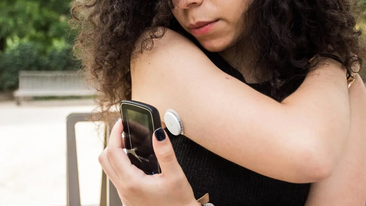 A young diabetic woman equipped with a glucose sensor and Freestyle Libre scanner. The scanner can just be flashed at the sensor on the back of the arm to instantly measure blood sugar levels. || Modellfreigabe vorhanden
