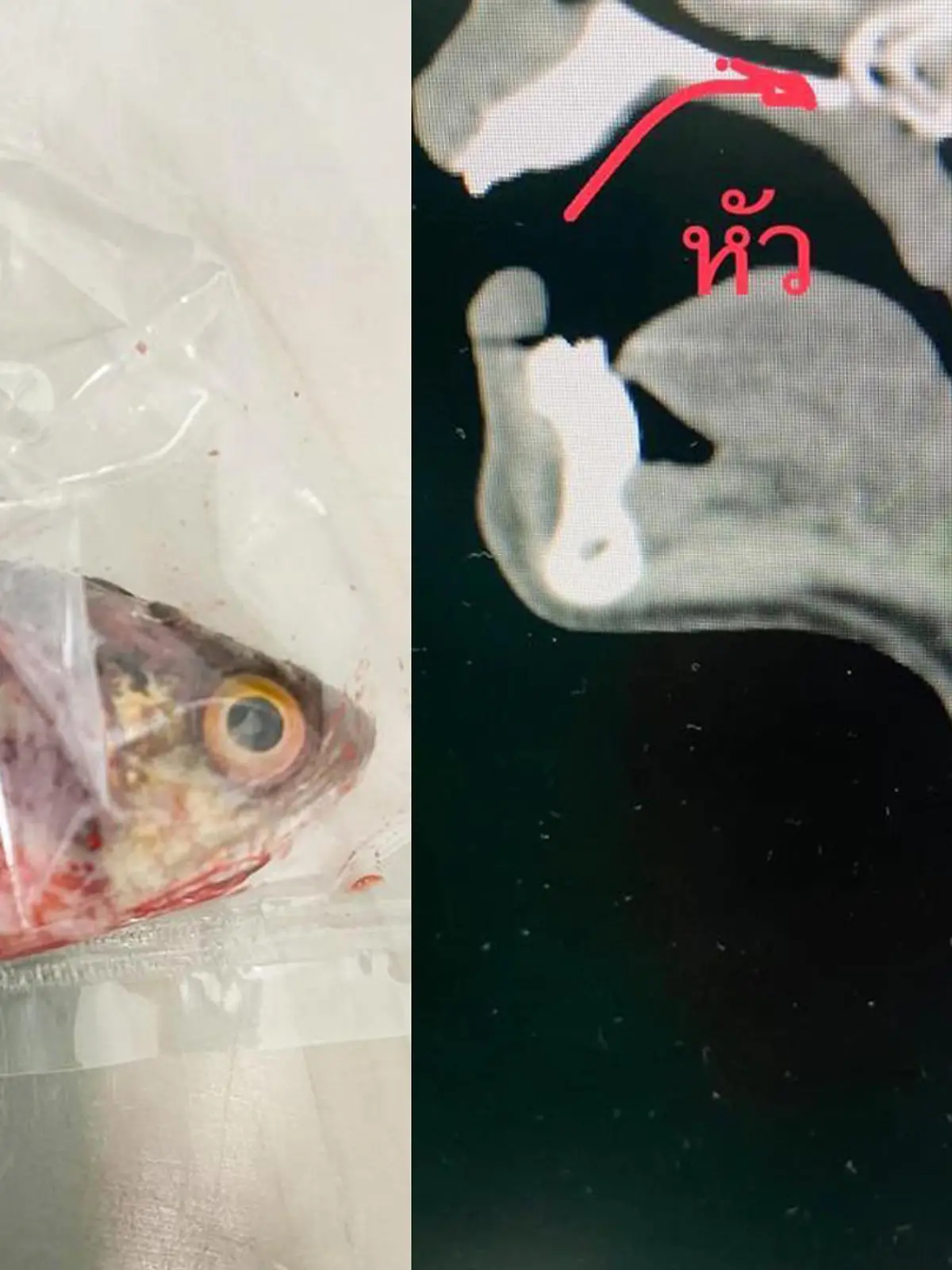 Thailand: Fischer muss notoperiert werden, weil ihm ein Fisch in den Rachen springt