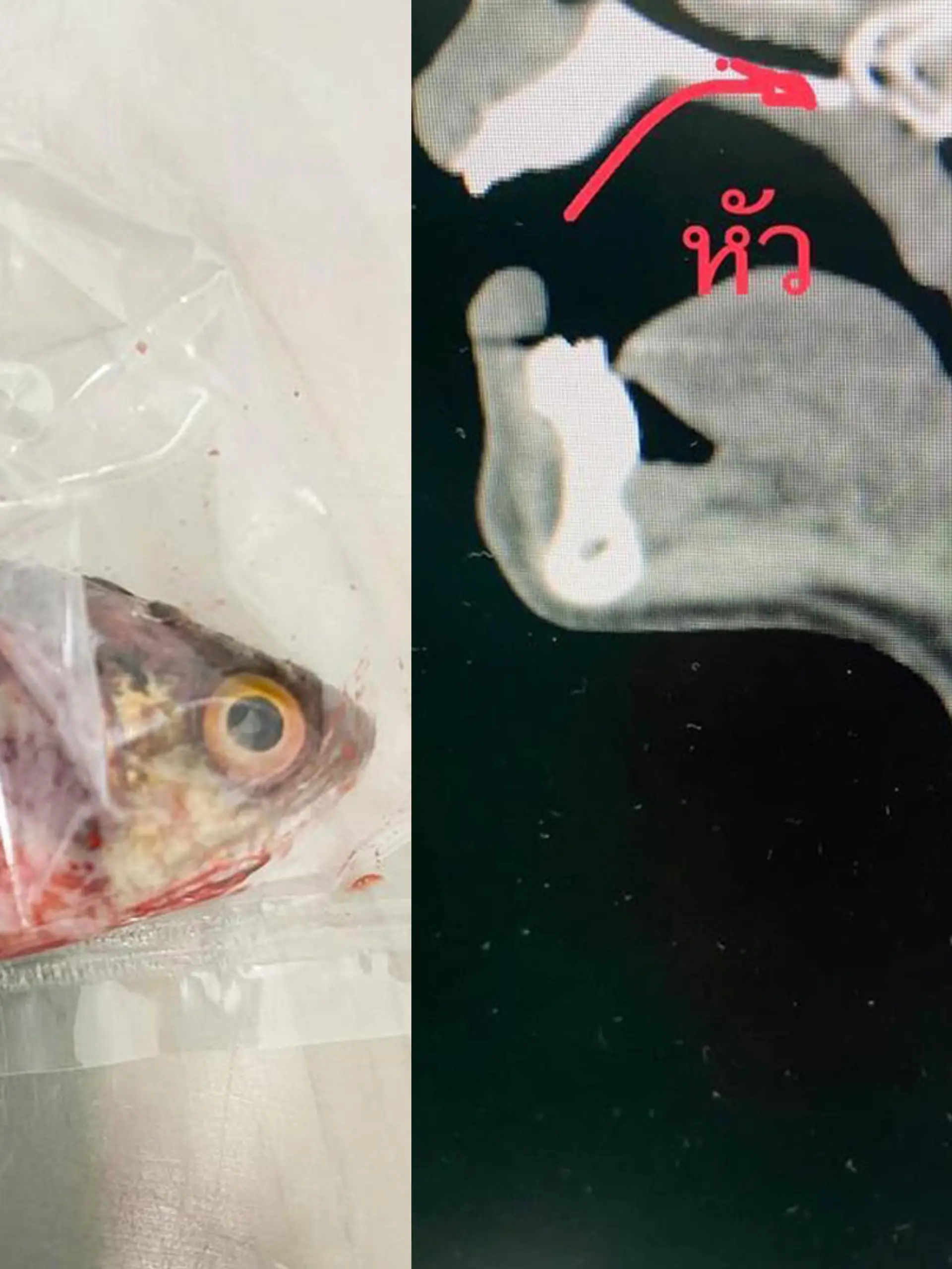 Thailand: Fischer muss notoperiert werden, weil ihm ein Fisch in den Rachen springt