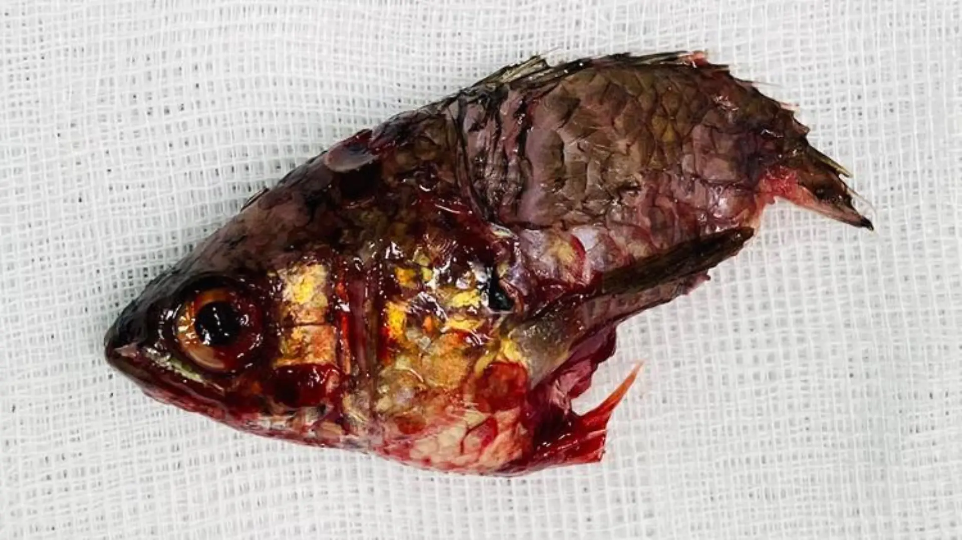 Doctors removed the five inch-long fish from the fisherman’s throat after a freak accident in Phatthalung, Thailand, on May 22, 2022. (Photo)

Doctors were baffled when the man arrived at the Phatthalung Provincial Hospital, claiming that a fish jumped inside his mouth on May 22.

A team immediately ran an x-ray on the fisherman and found the spiky freshwater Anabas fish lodged between his throat and nasal cavity as it tried to wriggle out through the man’s nose. 

The team of medics, two doctors assisted by three nurses, successfully removed the 5inch-long fish after a one-hour operation.

Hospital officer Sermsri Pathompanichrat said: ‘Our doctors worked hard to minimise the damage on our patient’s organs. They have successfully saved the patient.’

The doctors pulled the fish from the fisherman’s mouth as it was trying to wriggle out of his nose by passing through his throat.

When the fish was extracted, it was revealed to be a 5inch-long Anabas with sharp spikes, and covered in the man’s blood.

The unidentified patient told doctors he was spike-fishing with a harpoon under the surface of the water. He came up for air and at the same time, the Anabas coincidentally jumped out of the water and went straight into his mouth and down his throat.

The fish was stuck in his mouth and squeezed down his windpipe. He was rushed to the hospital after onlookers saw him appearing to gasp for air as he held his throat.

The fisherman was treated and is now in stable condition and recovering at the hospital from his operation wounds.

Hospital officer Sermsri Pathompanichrat added: 'The chances of this happening are very low. I have never seen this kind of case before.'

Anabas fish are freshwater carnivorous fish, that feed on insects and larvae.