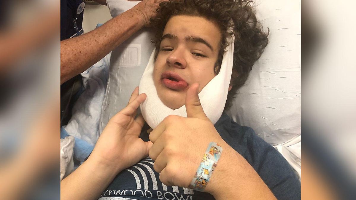 Keine Zähne durch kleidokraniale Dysplasie Diese Symptome hat