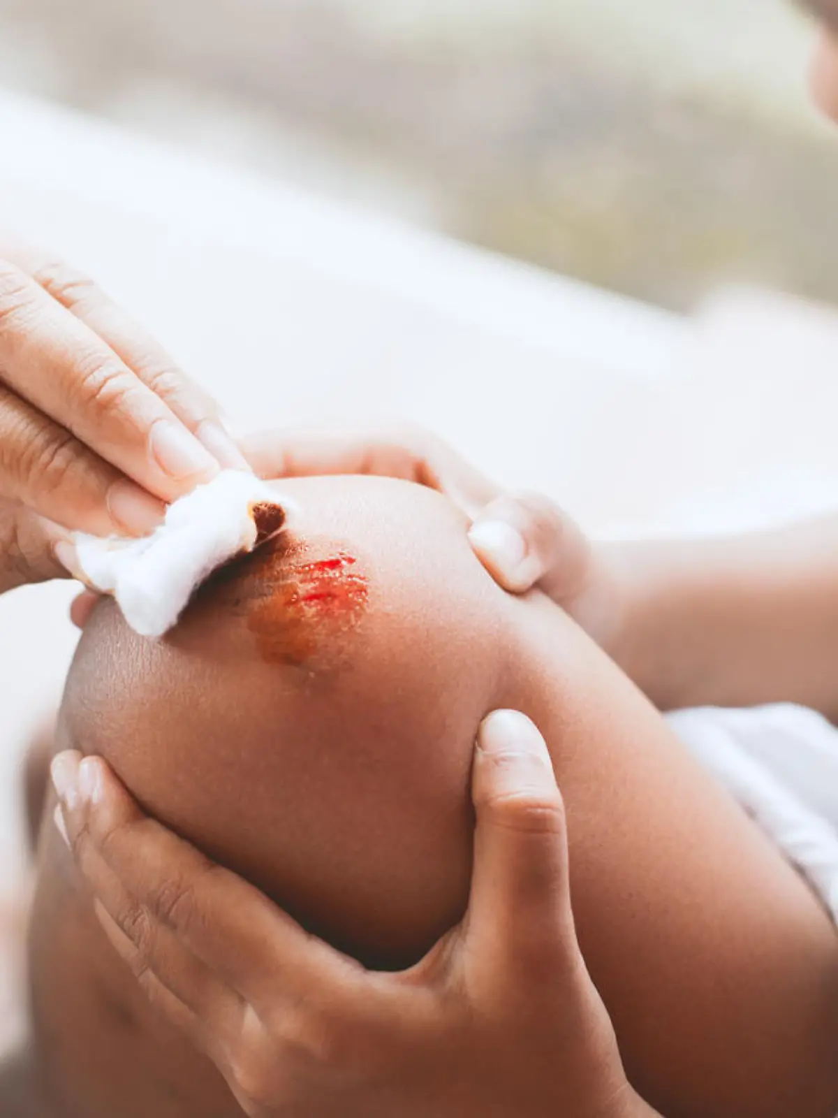 Parent helping her child perform first aid knee injury after she has been an accident