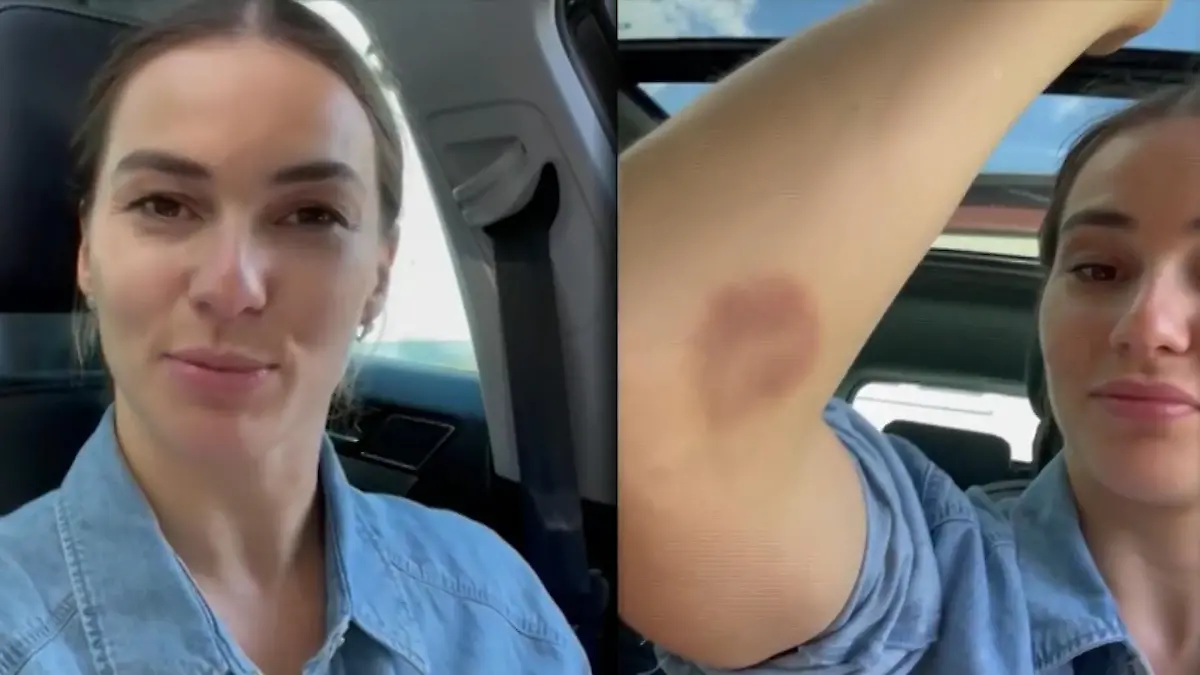 "Let's Dance"-Star Renata  Lusin zeigt ihre blauen Flecken "Bootcamp Christian Polanc" überlebt