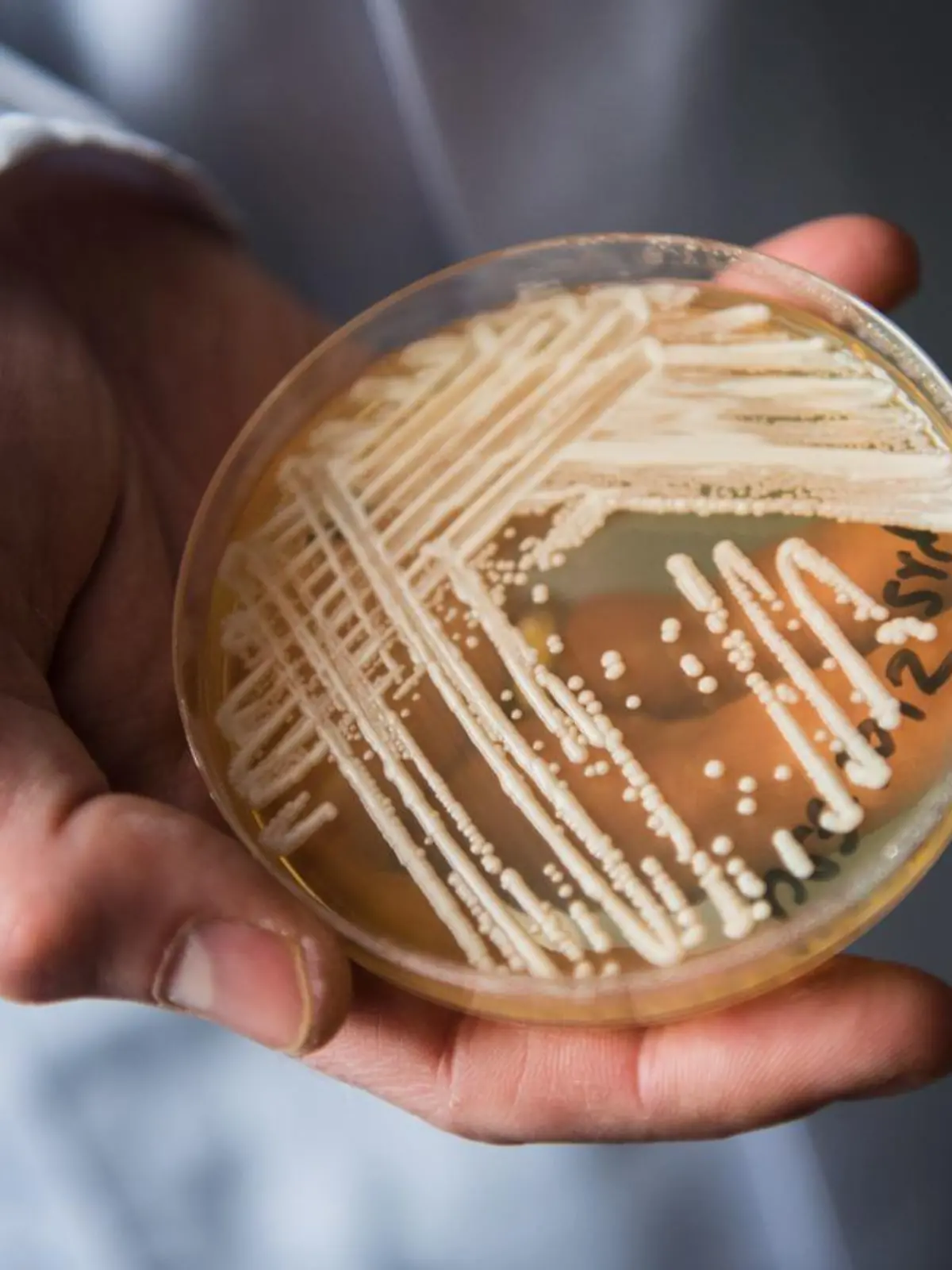 candida auris