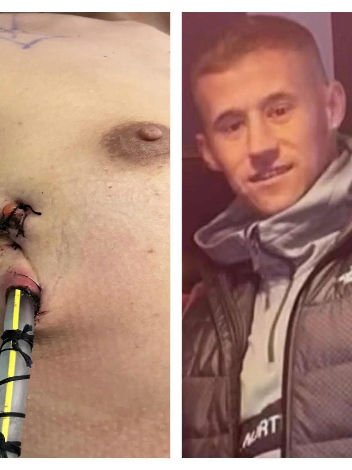 Collage Jordan Snowdon/OP