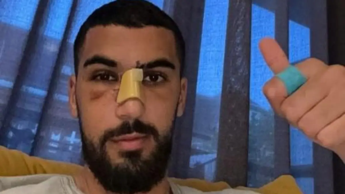 Aymen Barkok ist noch schwer gezeichnet.