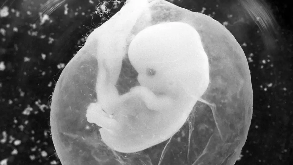 foetus-t10454