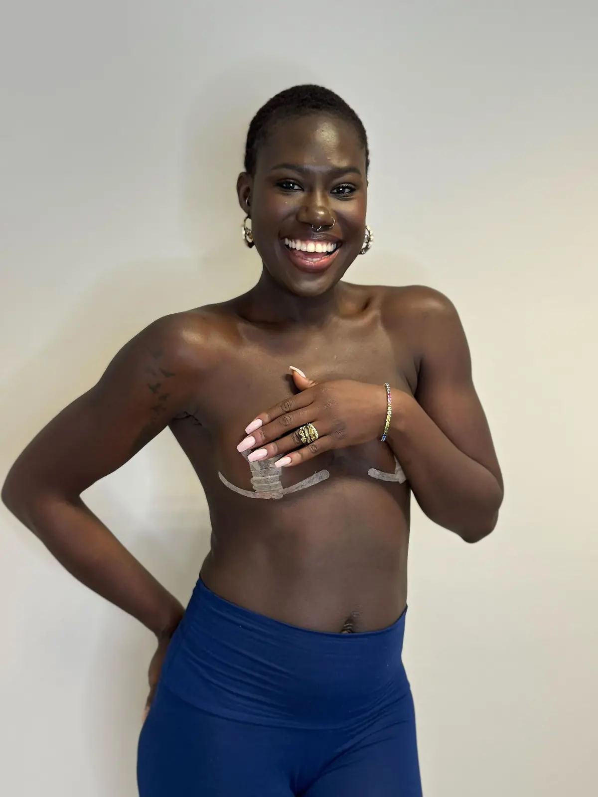 Ex-GNTM-Model Aminata Sanogo fühlt sich endlich wieder wohl in ihrer Haut.