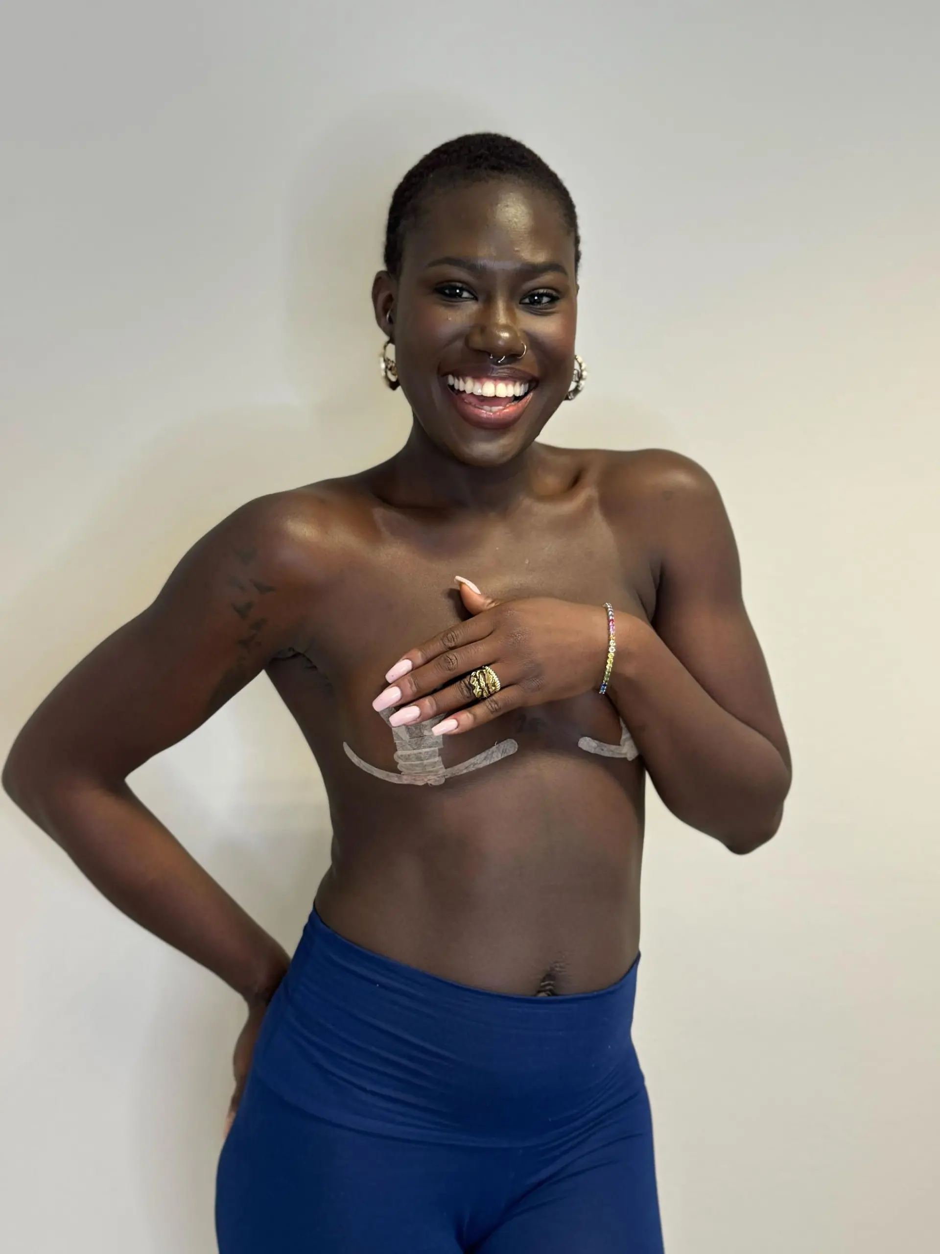 Ex-GNTM-Model Aminata Sanogo fühlt sich endlich wieder wohl in ihrer Haut.