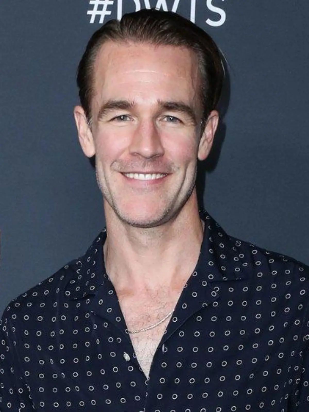 Darum zieht "Dawson's Creek"-Star James Van Der Beek plötzlich blank