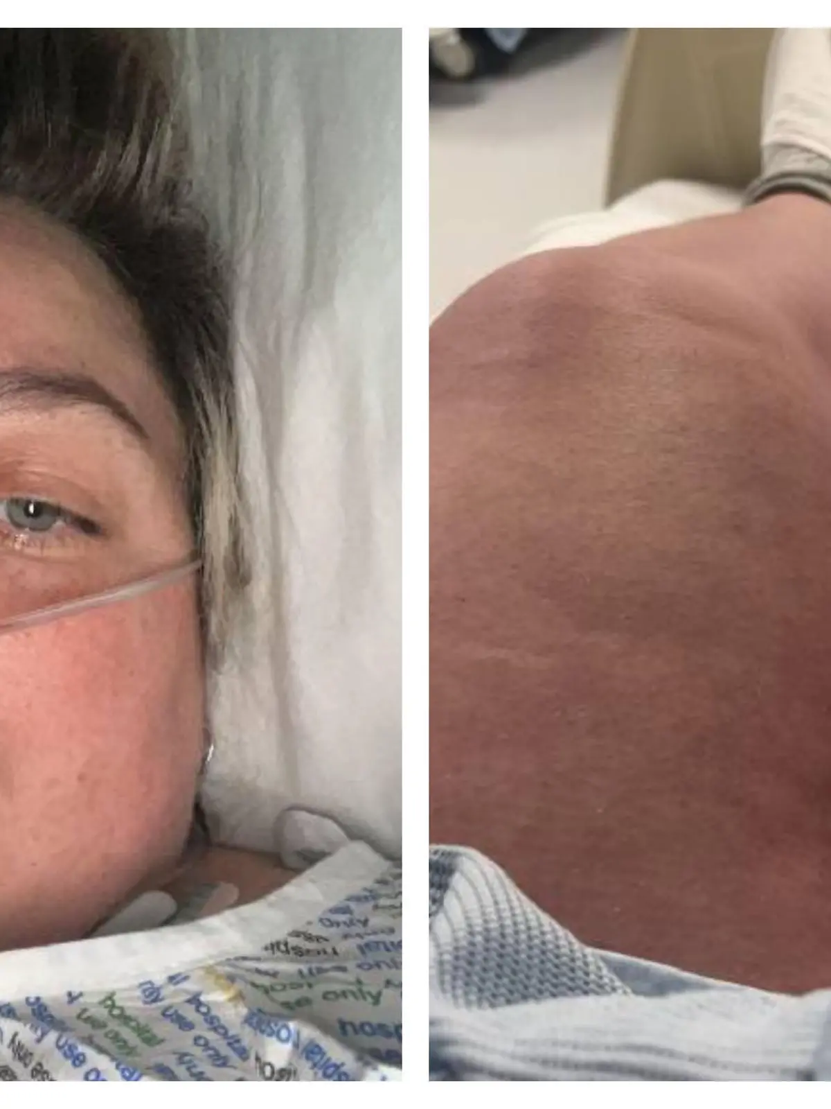 Collage Emma Tuthill im Krankenhaus / Emmas Bein