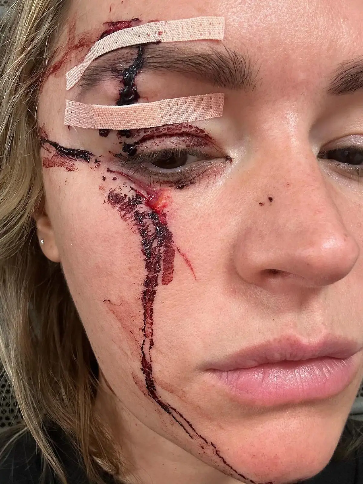 Laura Woods zeigt ihr schlimmen Verletzungen.