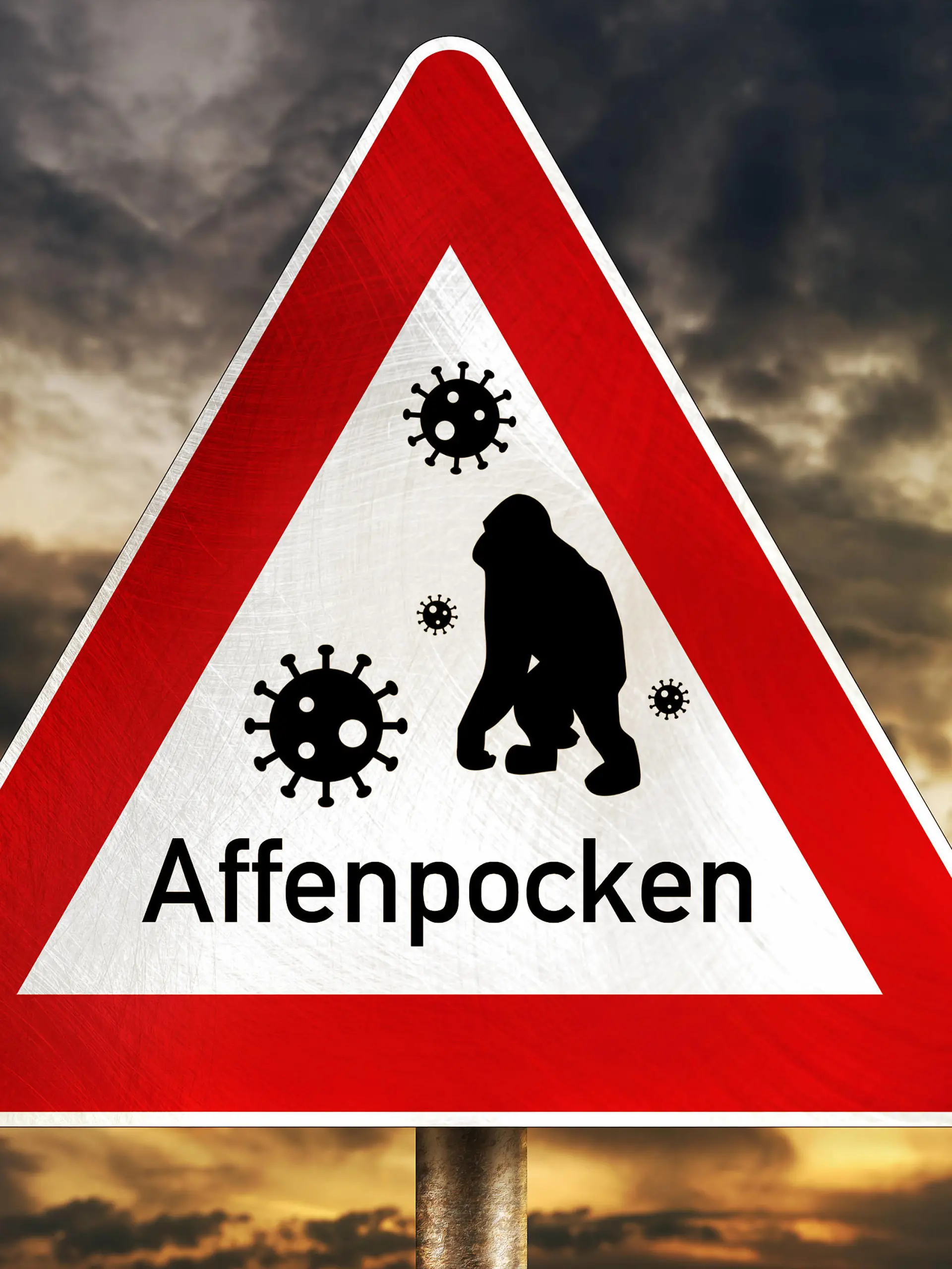  24 May 2022: Warning sign with inscription monkey pox, monkey pox PHOTOMONTAGE *** Warnschild mit Aufschrift Affenpocken, Affen Pocken FOTOMONTAGE