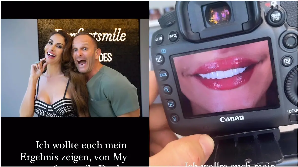 Janina Youssefian präsentiert stolz ihr neues Lächeln auf Instagram.