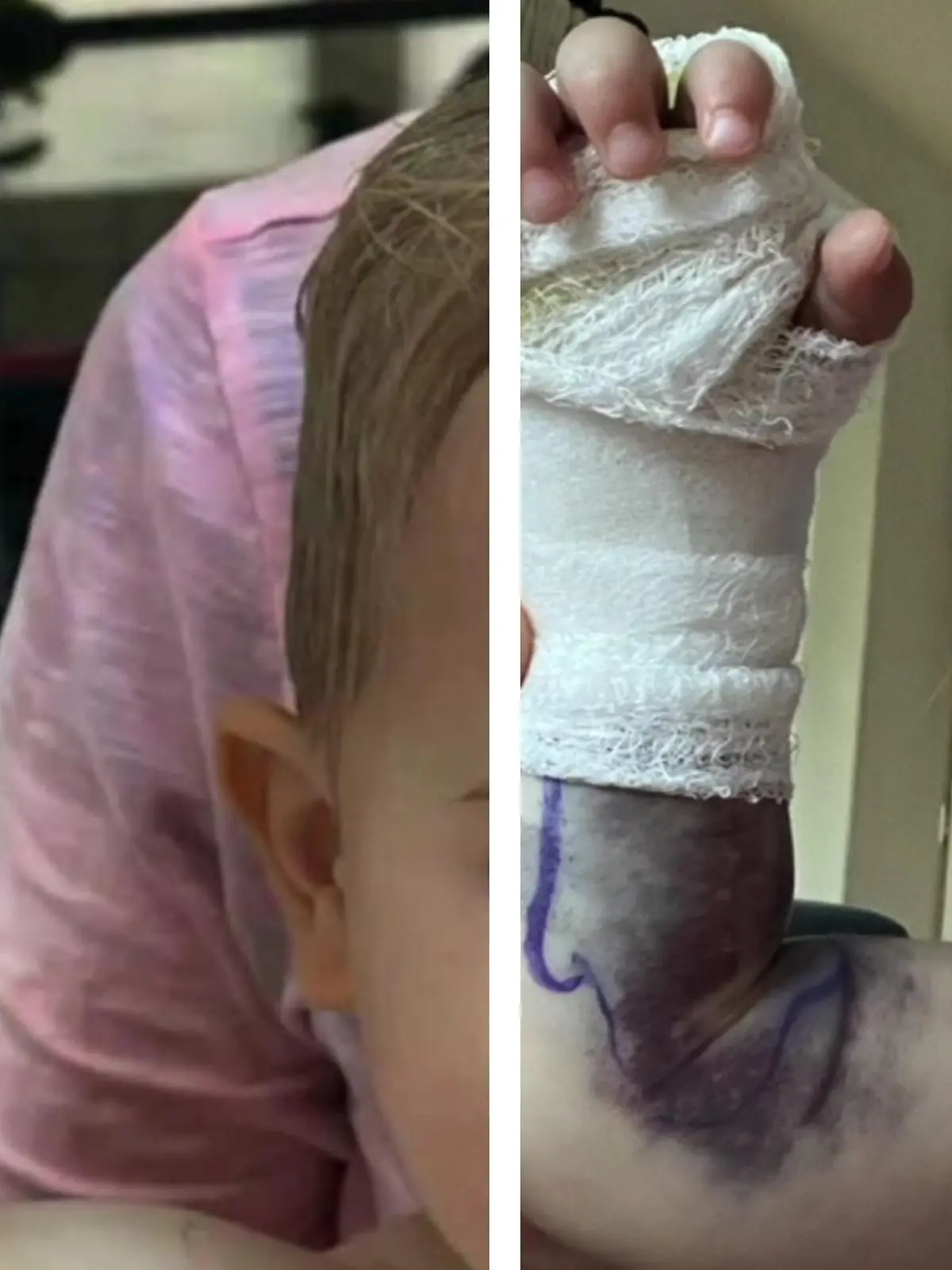 30 Gegengift-Ampullen!
Der zweijährige Brigsby wird von einer Klapperschlange gebissen und seine Venen fangen sofort an sich zu verschließen. Alle rechnen bereits damit, dass der Kleine es nicht schaffen wird. Doch mit einer ganz bestimmten Methode können die Ärzte in San Diego das kleine Wunder retten. Wie? Das sehen Sie im Video.