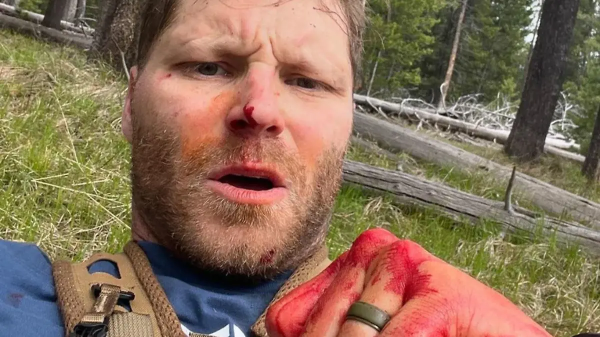 Shayne Patrick Burke überlebte den Angriff einer Grizzlybärin.