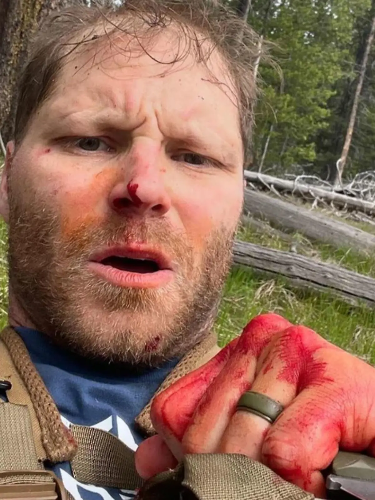 Shayne Patrick Burke überlebte den Angriff einer Grizzlybärin.