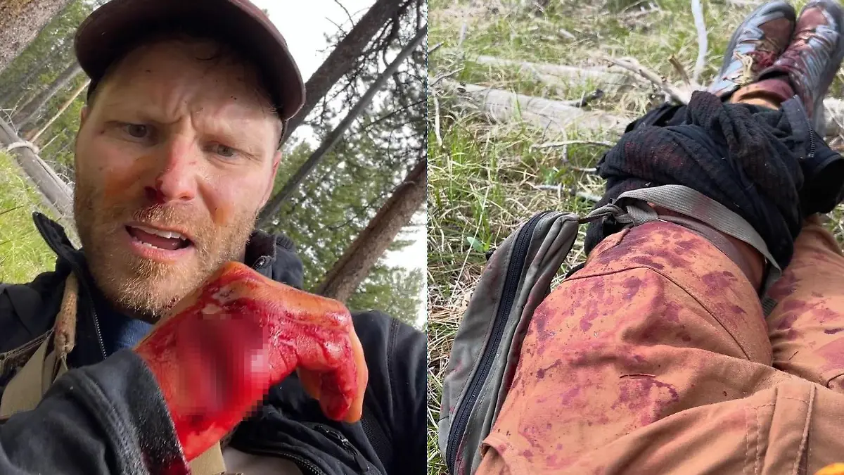 Blutend und verletzt bleibt der 35-Jährige nach der Bärenattacke zunächst im Wald zurück.