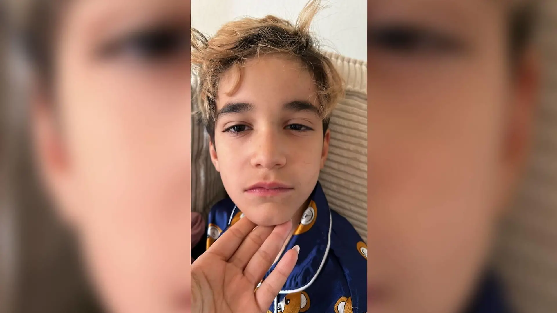 Noah nach Begegnung mit Eichenprozessionsspinner.