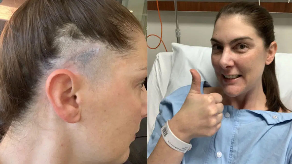 Großer blauer Fleck auf der Kopfhaut? Auf Anraten einer Freundin ließ Lee den Fleck untersuchen.