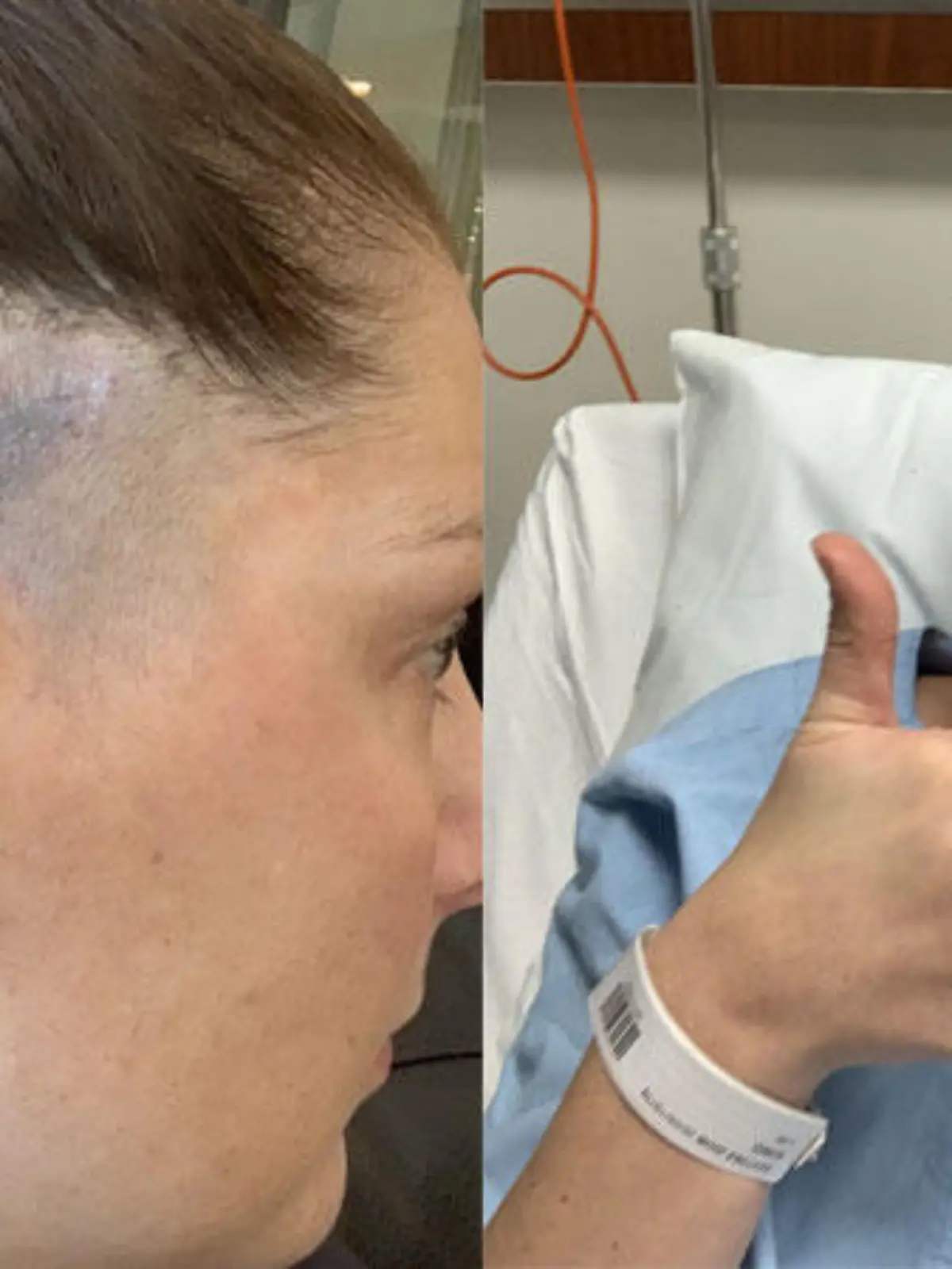 Großer blauer Fleck auf der Kopfhaut? Auf Anraten einer Freundin ließ Lee den Fleck untersuchen.