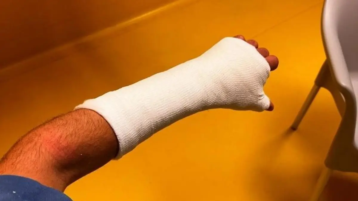 Sieht schlimmer aus als es ist: An der Hand erleidet Tulovic nur eine kleinere Verletzung.