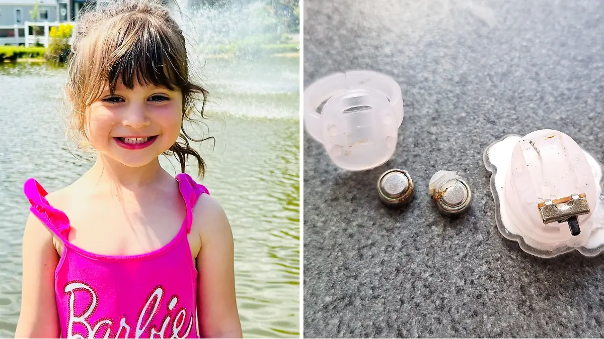 Isabella verschluckte eine Knopfzelle aus einem Spielzeug