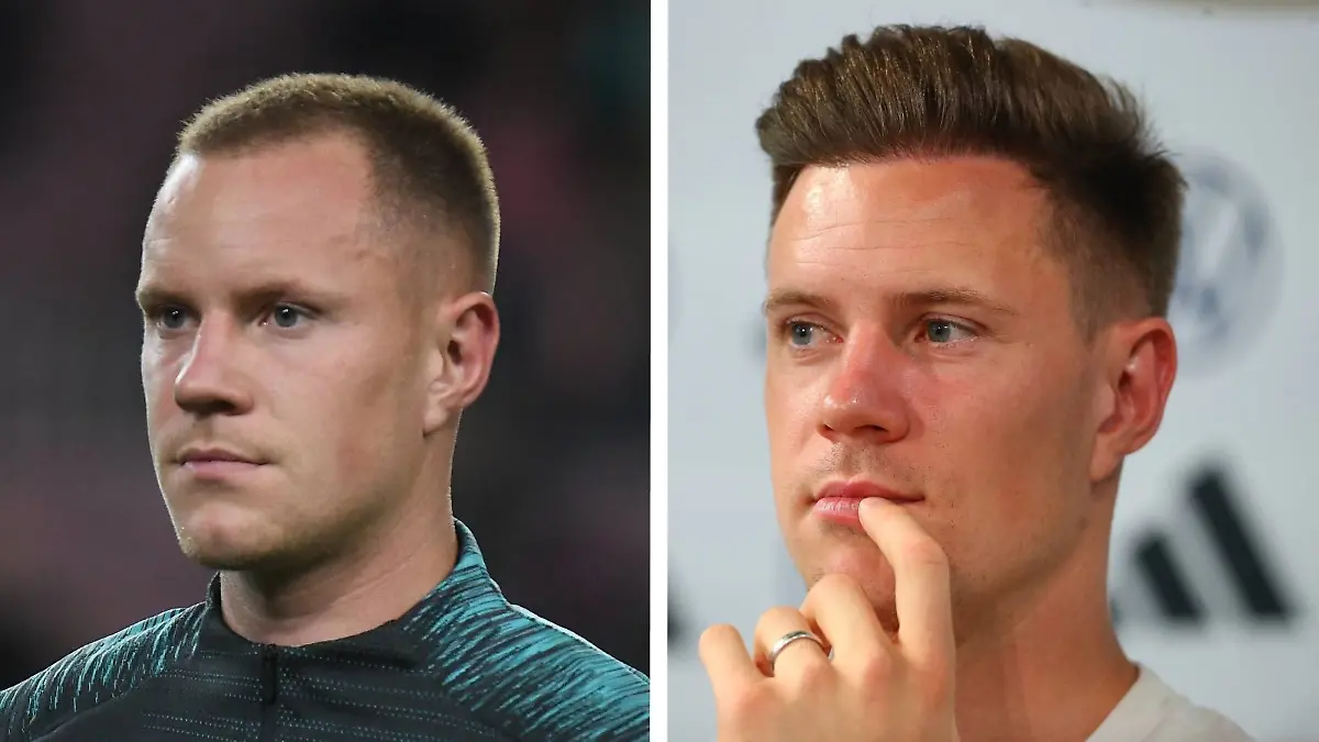Torwart Marc-André ter Stegen (32) hat’s getan! Er hat sich vor ca. fünf Jahren die Haare transplantieren lassen.