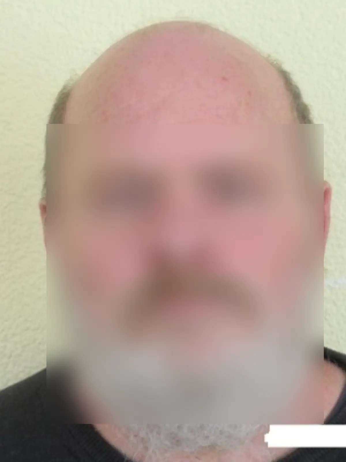 Die Polizei sucht nach diesem Mann.  Zudem bittet die Polizei derzeit darum, im Großraum Haina/Kloster keine Anhalter mitzunehmen.