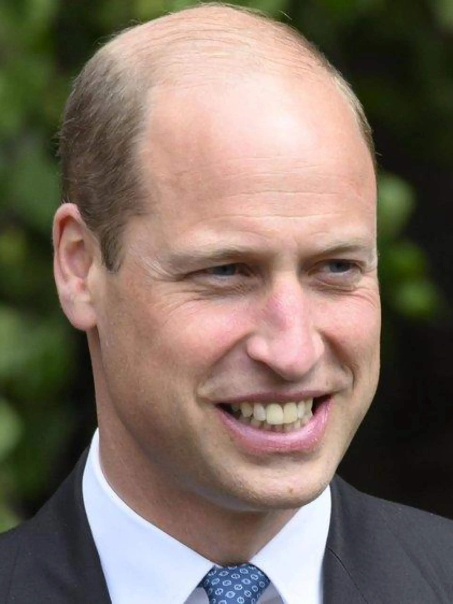 Prinz William scherzt über seine "Harry Potter"-Narbe