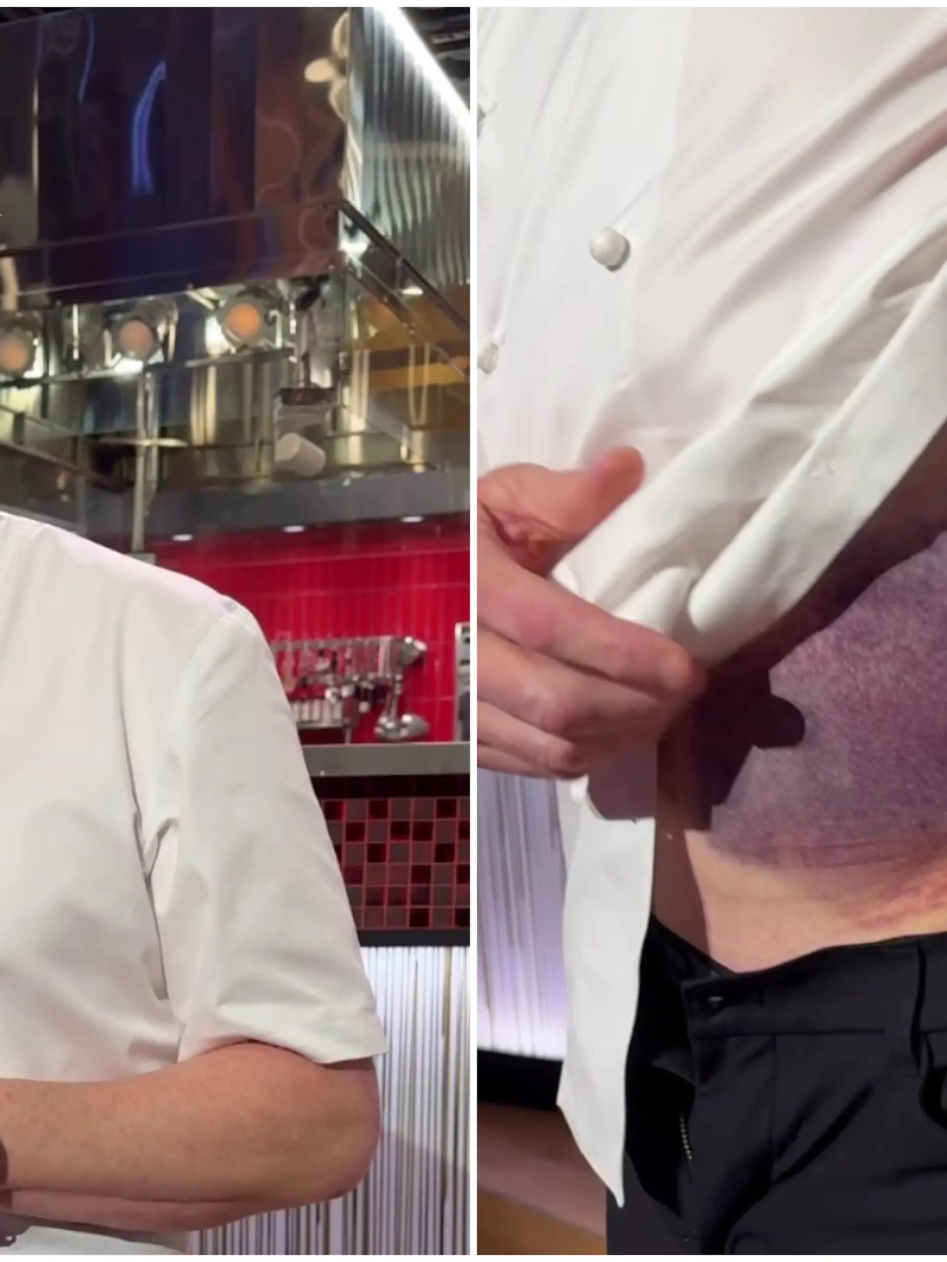 TV-Koch Gordon Ramsay zeigt seiner Community die schweren Verletzungen nach einem Fahrradunfall