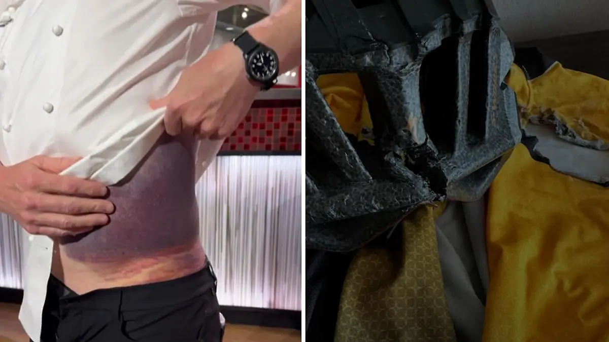 Gordon Ramsay bei Fahrradunfall fast gestorben TV-Koch zeigt seine krassen Verletzungen!
