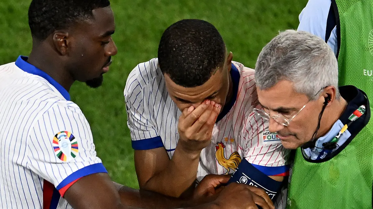 Mbappé (M) musste mit stark blutender Nase ausgewechselt werden.