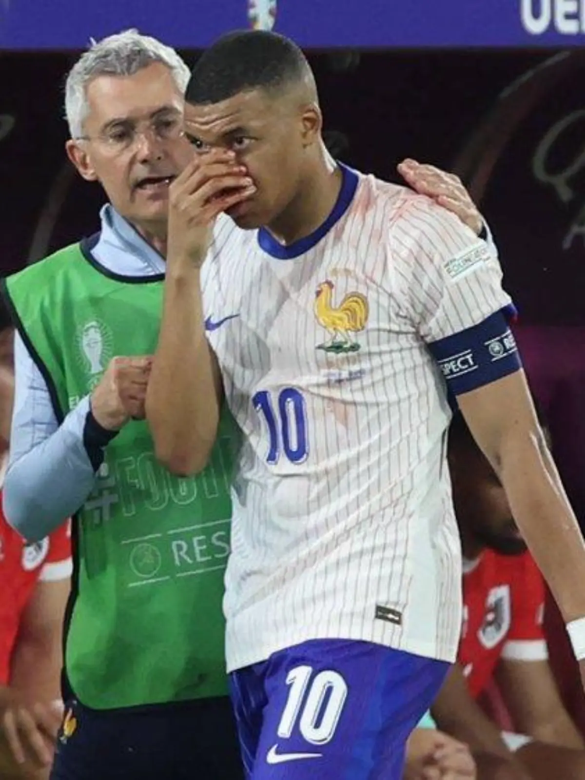 EM 2024: Kylian Mbappé reagiert auf Nasenbeinbruch mit Humor