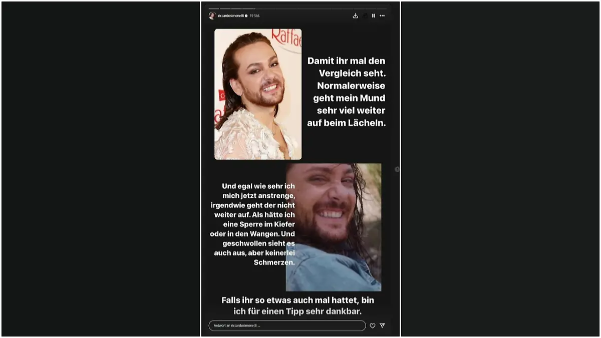 Riccardo Simonetti zeigt bei Instagram einen Vorher-Nachher-Vergleich.