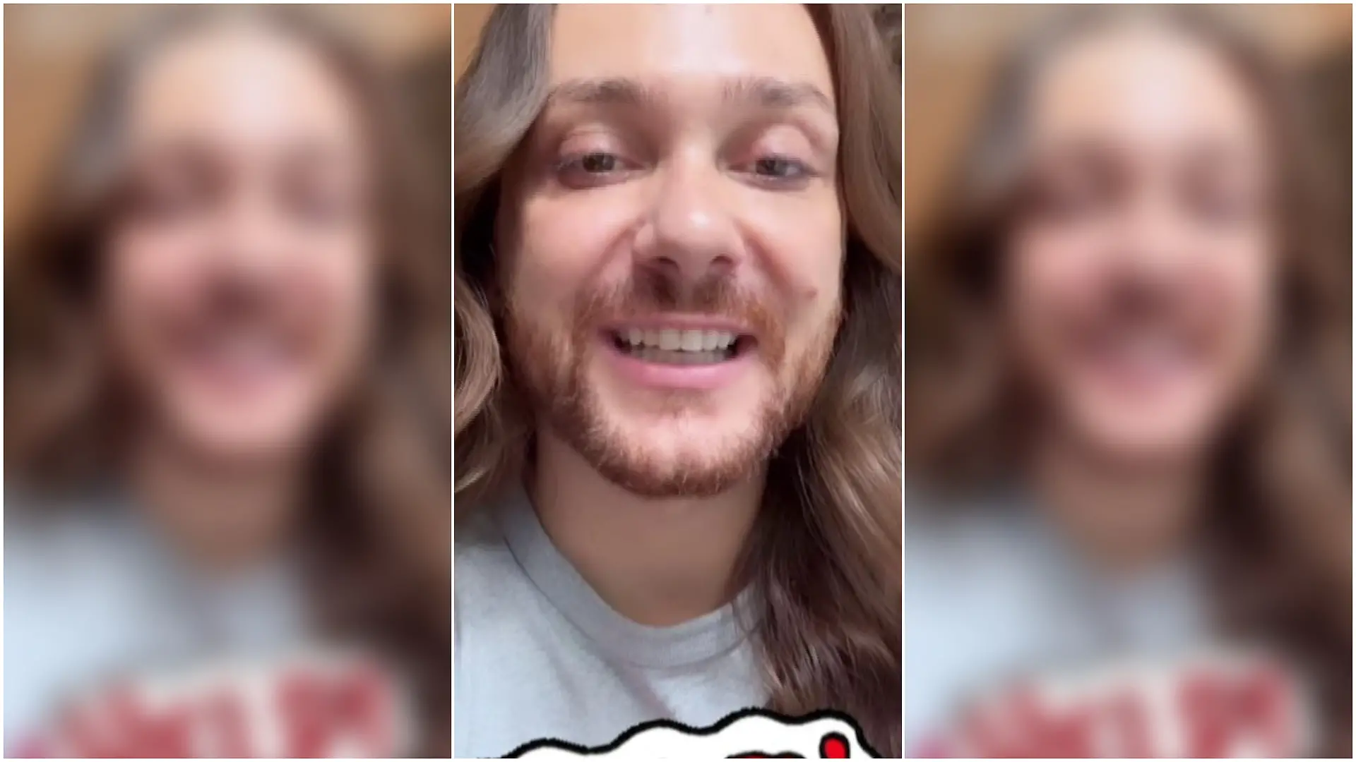 Riccardo Simonetti macht sich Sorgen um sein Gesicht.