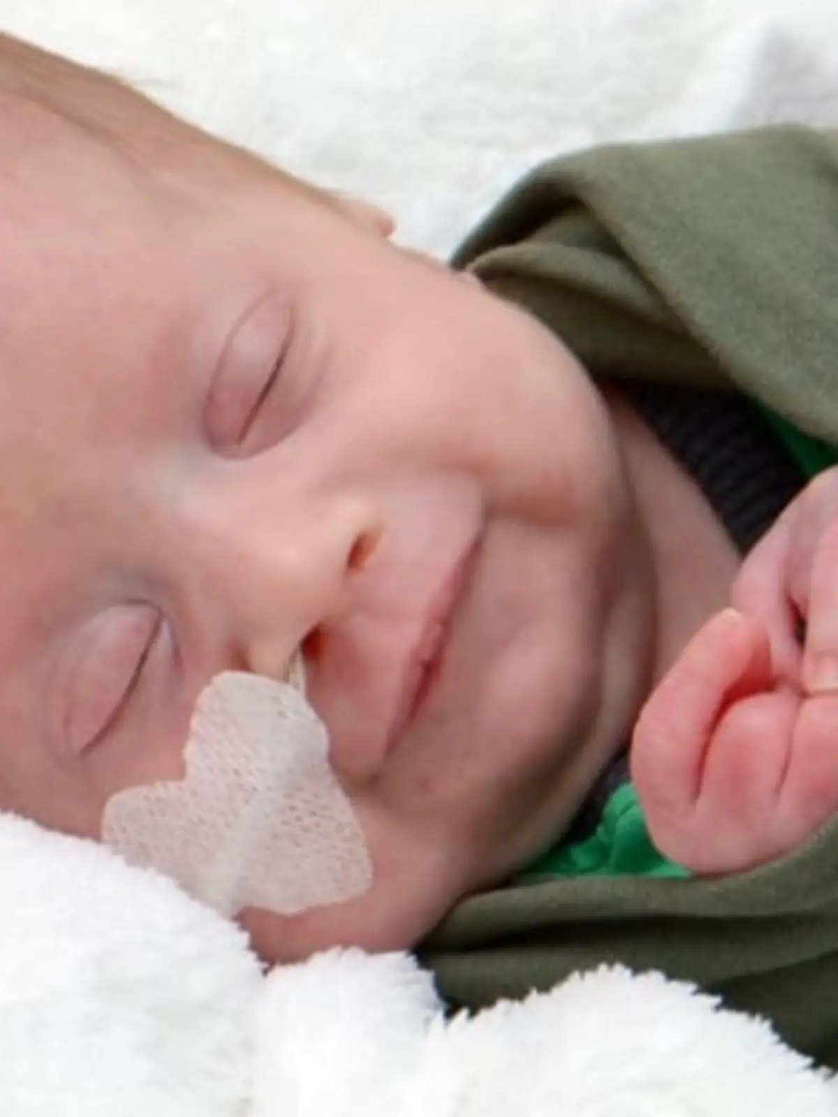 Baby Henner hat Trisomie 9 Mosaik
