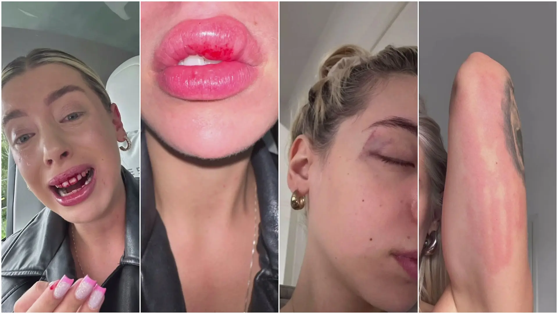 Unter anderem diese Bilder zeigt Walentina Doronina in ihrem Instagram-Reel.