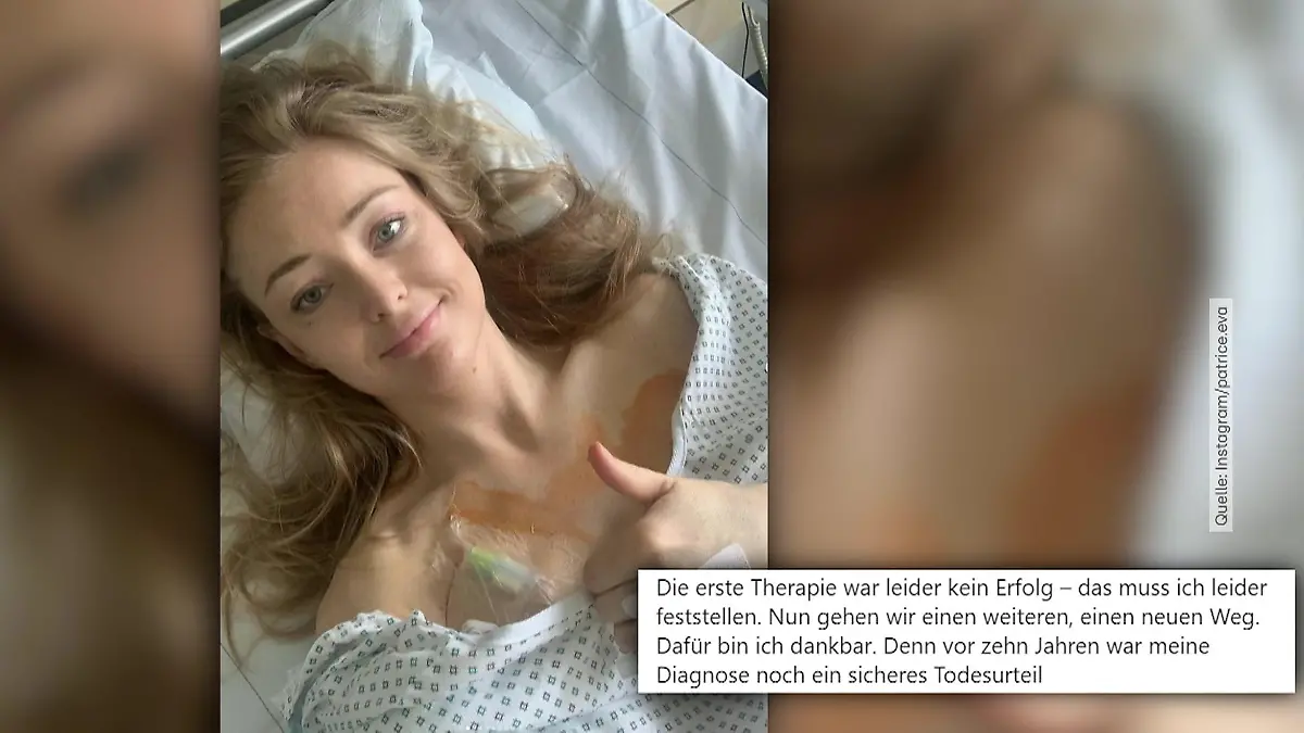 Neue Therapie für Patrice Aminati Hoffnung im Kampf gegen den Krebs