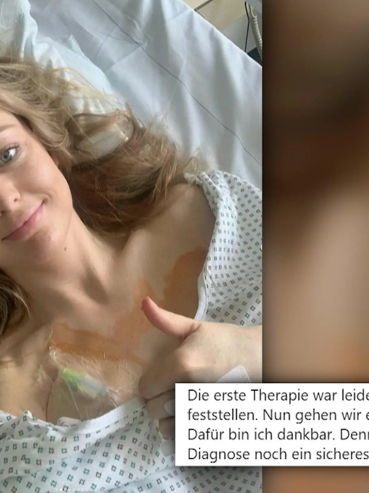 Bild zu: "Neue Therapie für Patrice Aminati"