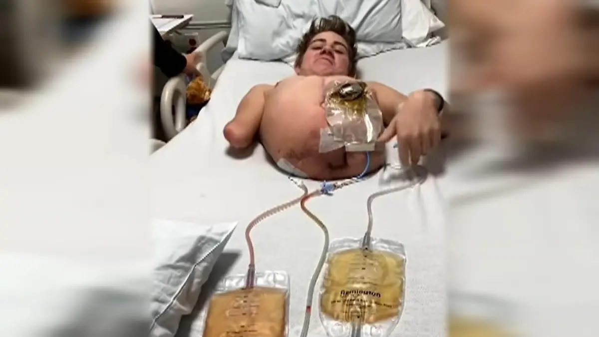 Gabelstapler-Unfall Loren Schauers